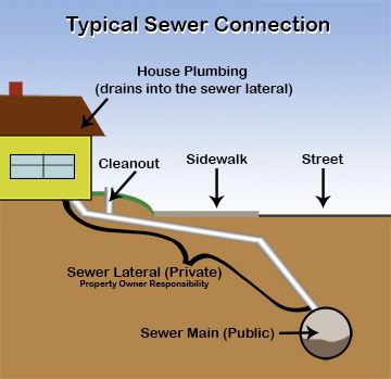 Sewer Lateral